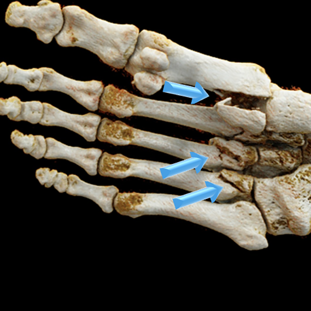Interactive Multimedia Radiology Reporting