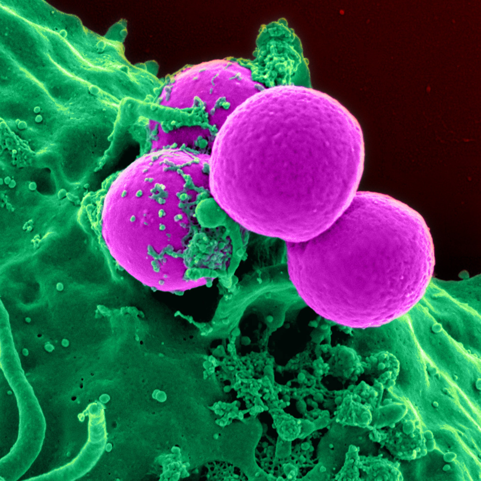 The Evolution of Thyroid Cancer Theranostics