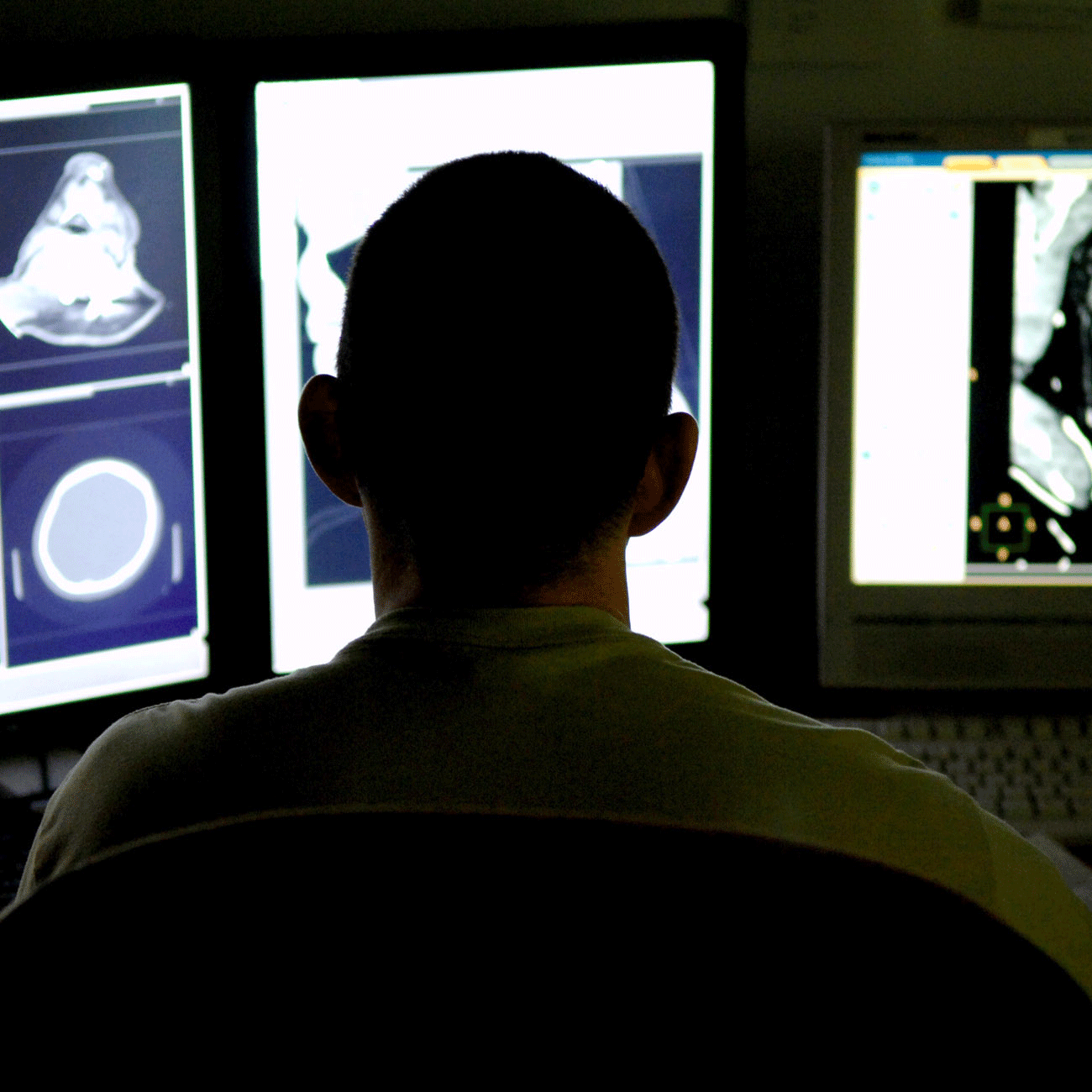 Radiology Residency in the Midst of COVID-19