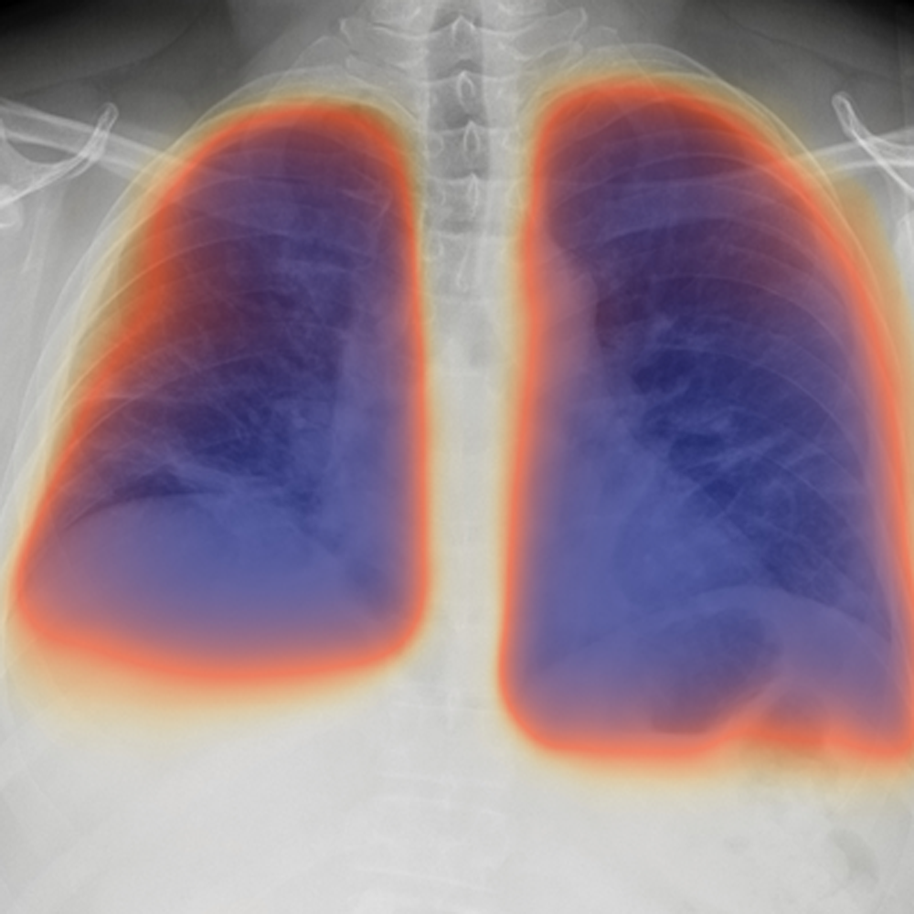 The Journey to AI for COVID-19 Radiography