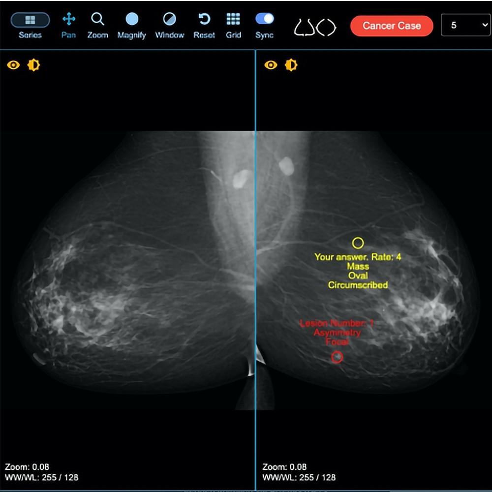 Continuing Radiologist Education—A New Paradigm Using Clinical Test Sets