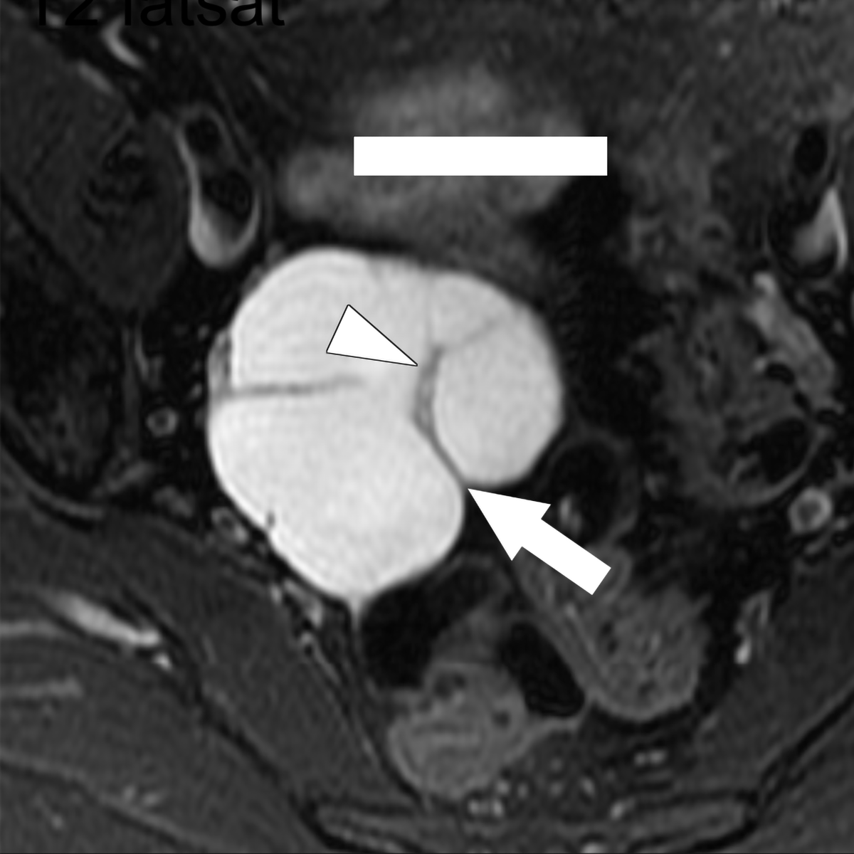 Making the Most of MRI: Practical and Advanced Body Applications
