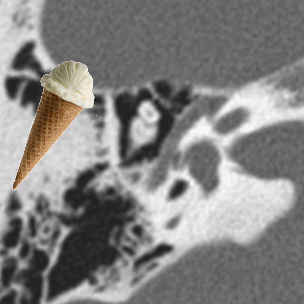 Everything You’ve Wanted to Know About Temporal Bone Imaging (But Were Afraid to Ask!)