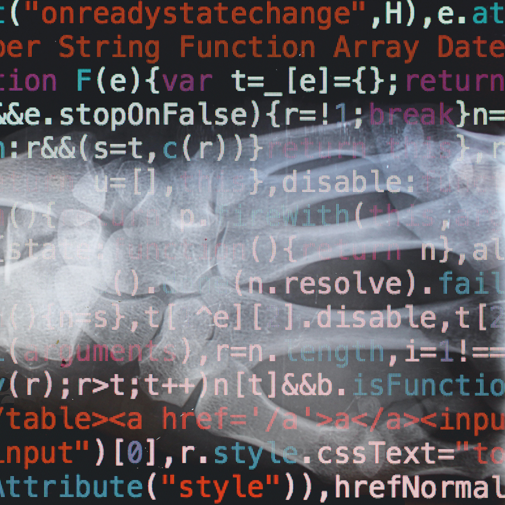 Musculoskeletal Imaging, Meet Computational Science