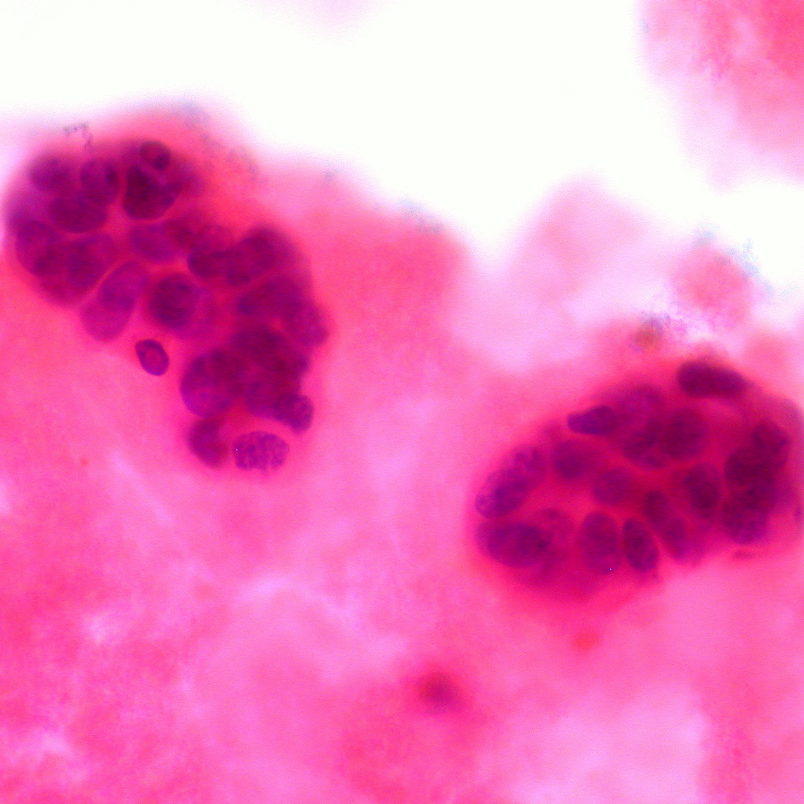 Multimodality Breast Imaging and Biopsy—Updates for Your Practice