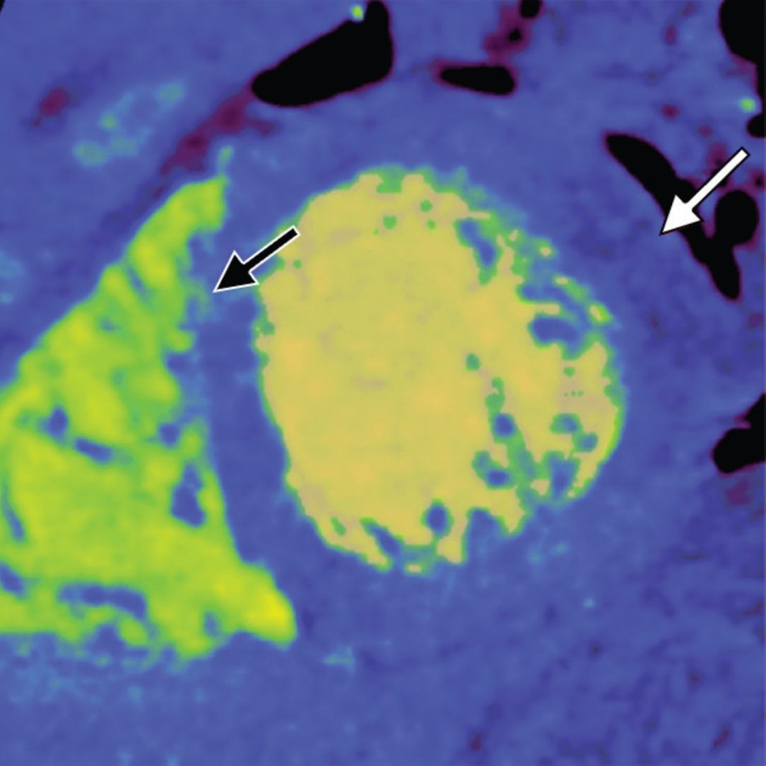 Traumatic Emergencies in Cardiac Imaging