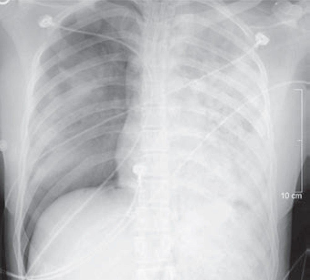 ARRS Publishes First Issue of New Journal, Roentgen Ray Review (R3)