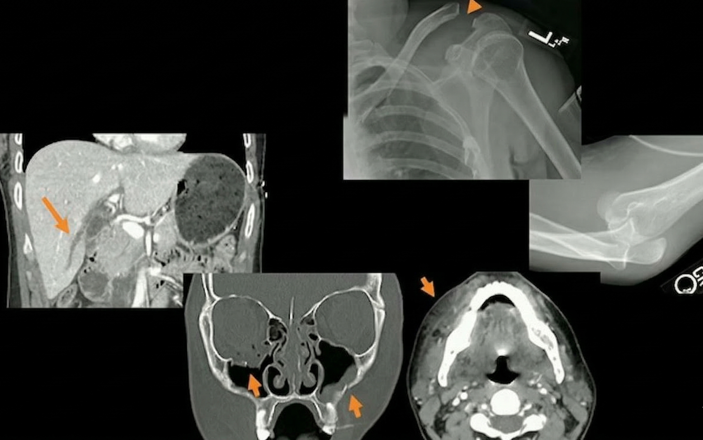 Radiologic Red Flags: Combinations of Intimate Partner Violence