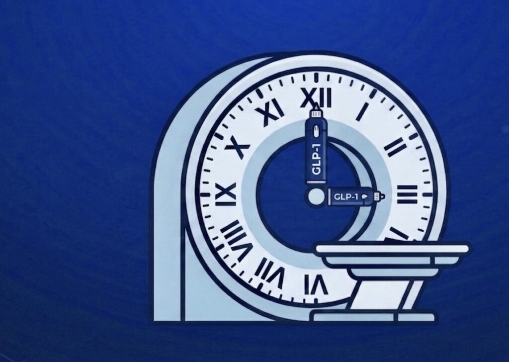 GLP-1s & FDG PET/CT: No Time for Adjustment
