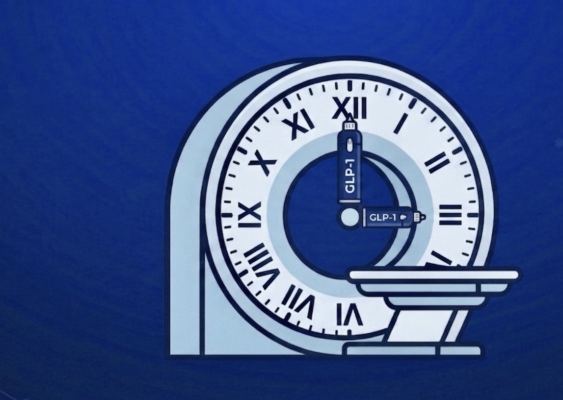GLP-1s & FDG PET/CT: No Time for Adjustment